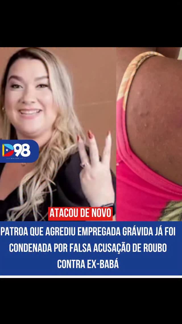 Carolina Sthela, empresária investigada por espancar uma doméstica grávida de cinco meses em Paço do Lumiar, já tinha histórico: foi condenada por acusar falsamente uma babá de 17 anos de roubo.
A vítima tem 19 anos e foi agredida com socos, tapas e murros por mais de uma hora. A joia que motivou a acusação foi encontrada no cesto de roupas da própria casa — mas as agressões não pararam.
Nos áudios que ela mesma enviou, Carolina afirmou que a empregada "não era pra ter saído viva". E revelou que não foi presa porque o policial que atendeu à ocorrência era seu amigo.
Mesmo com tudo isso, ela segue solta e sem indiciamento. A OAB já se manifestou e a Polícia Civil apura o caso. 👇 Justiça vai acontecer? Comenta aqui!
📲 Leia a matéria completa no link da bio.
diario98.com
#PaçoDoLumiar #Maranhão #Violência #Justiça #Diário98